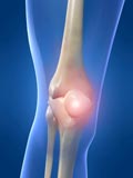 Glucosamine Supplements Treat Arthritis